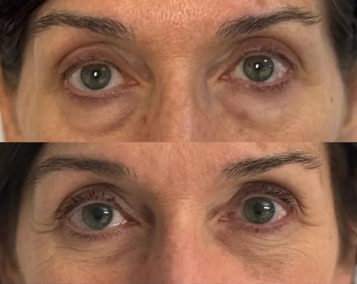 Before (top) and after (bottom), case published by Dr Hayot on January 8, 2025