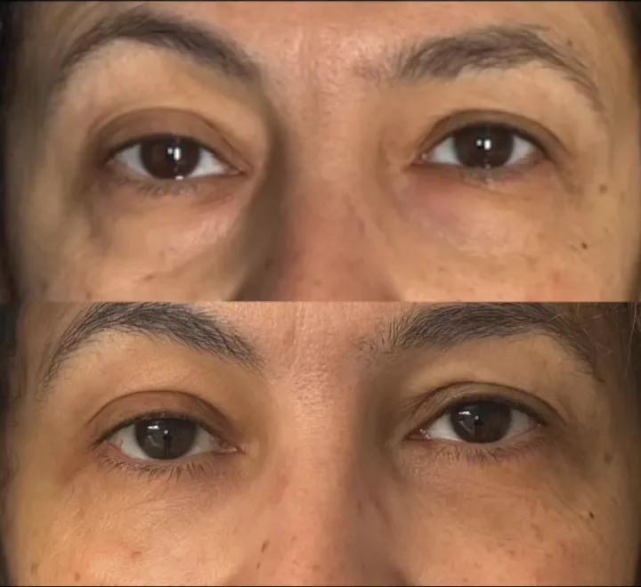 Before (top) and after (bottom), case published by Dr Hayot on February 3, 2025