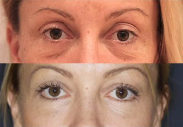 Before (top) and after (bottom), case published by Dr Hayot on April 24, 2025