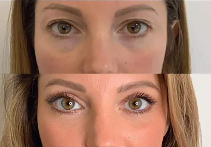 Before (top) and after (bottom), case published by Dr Hayot on May 12, 2025