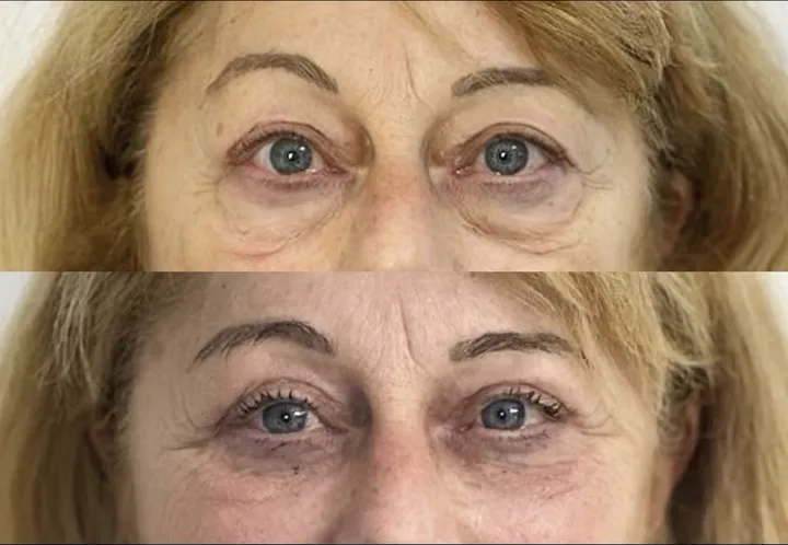 Before (top) and after (bottom), case published by Dr Hayot on July 9, 2025