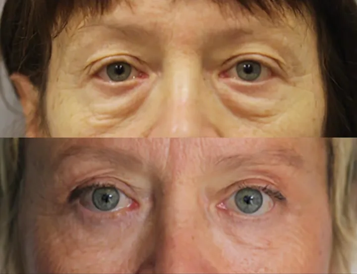 Before (top) and after (bottom), case published by Dr Hayot on June 26, 2025