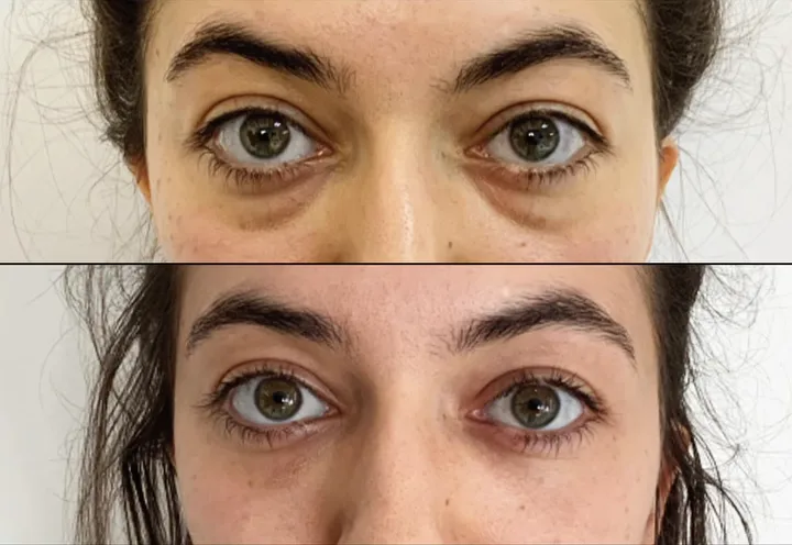 Before (top) and after (bottom), case published by Dr Hayot on July 2, 2025