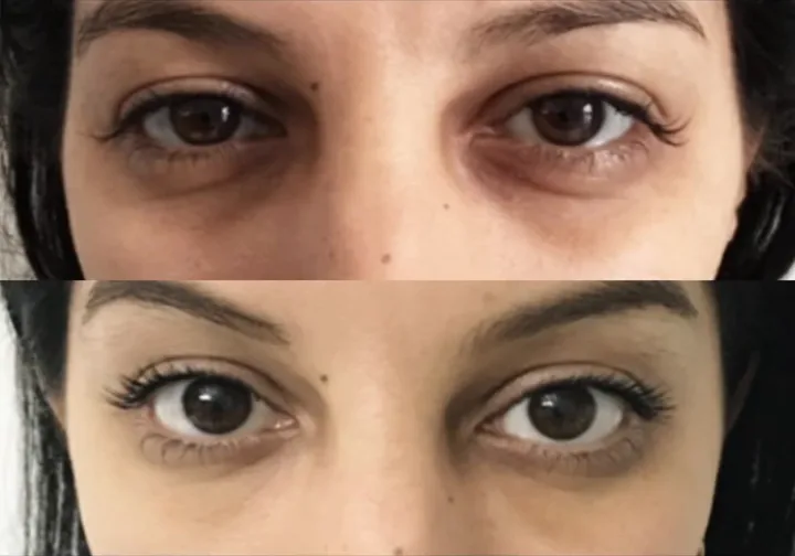 Before (top) and after (bottom), case published by Dr Hayot on July 16, 2025