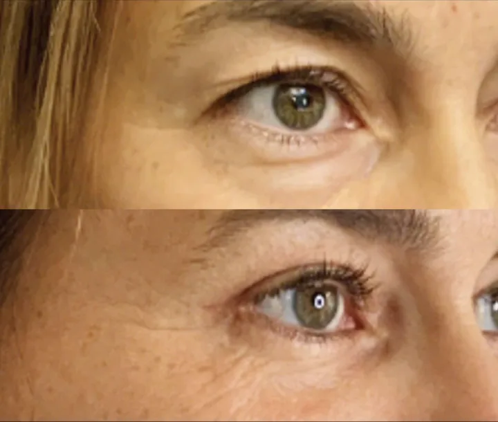 Before (top) and after (bottom), case published by Dr Hayot on August 14, 2025