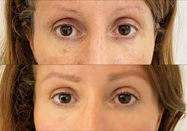 Before (top) and after (bottom), case published by Dr Hayot on September 12, 2025