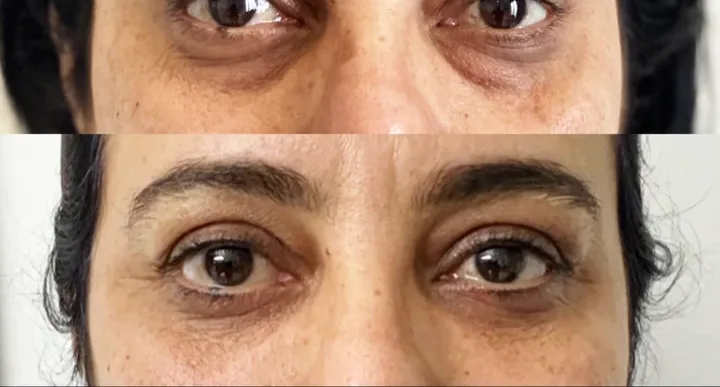 Before (top) and after (bottom), case published by Dr Hayot on November 27, 2025