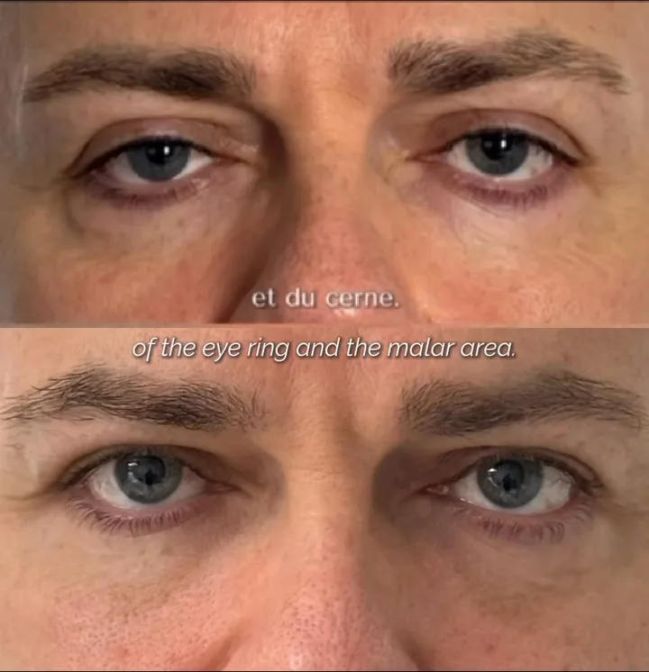 Before (top) and after (bottom), case published by Dr Hayot on December 17, 2025