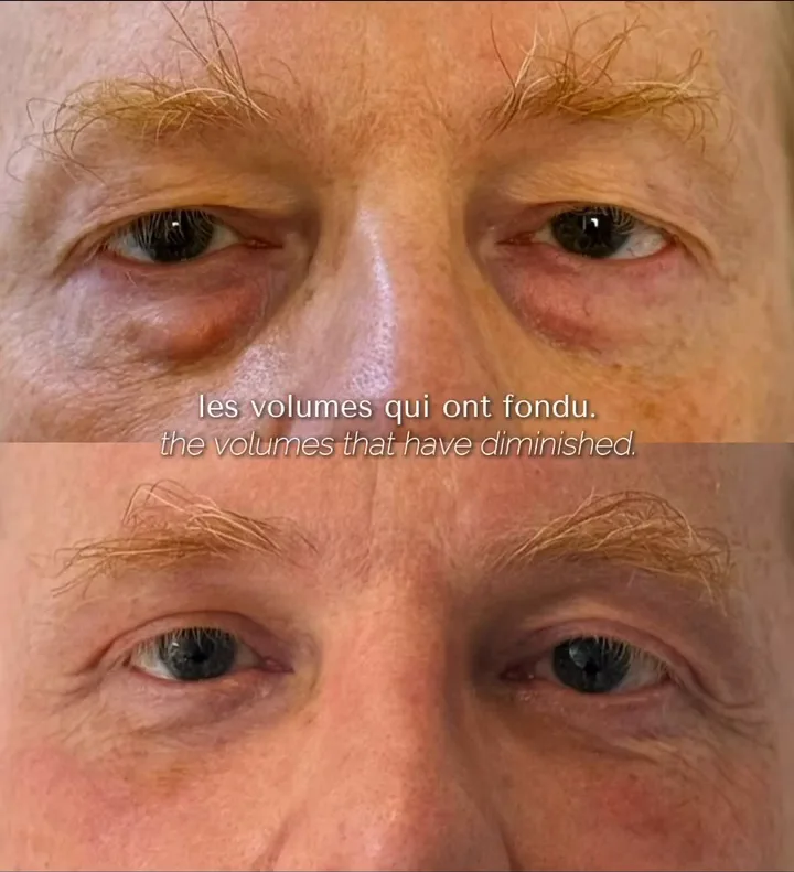 Before (top) and after (bottom), case published by Dr Hayot on January 2, 2026