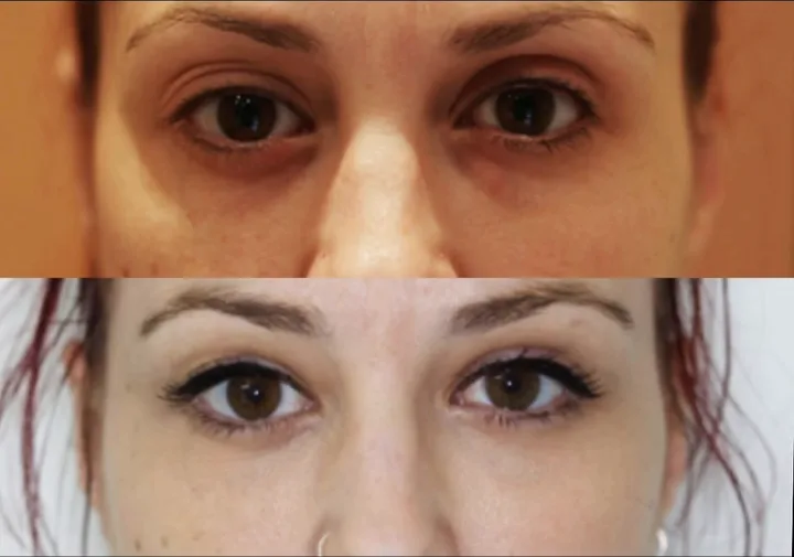 Before (top) and after (bottom), case published by Dr Hayot on February 20, 2026