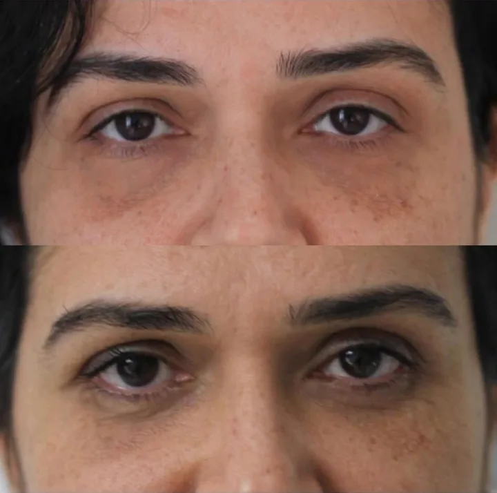 Before (top) and after (bottom), case published by Dr Hayot on April 5, 2026