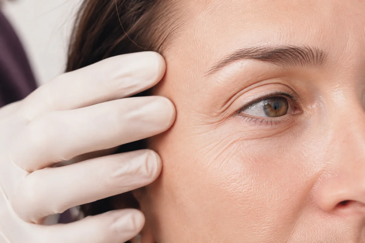 Injections de botox et d’acide hyaluronique (concentration déterminée en consultation) décomplexé !
