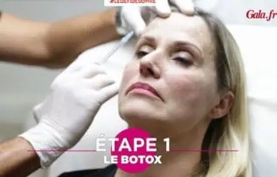 Новости – Docteur Bernard Hayot Знаменитости и инъекции ботокса