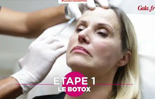 Celebrities and botox injections