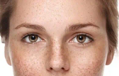 Новости – Docteur Bernard Hayot Медицинская ринопластика: коррекция формы носа без хирургического вмешательства