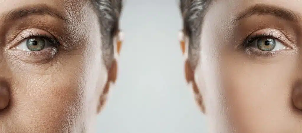 Rajeunir le regard après 50 ans : Chirurgie et alternatives – Docteur Bernard Hayot Les signes du vieillissement du regard apres 50 ans – Docteur Bernard Hayot