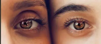 Actualités – Docteur Bernard Hayot Retendre le regard sans altérer l’expression