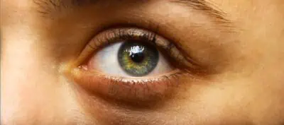 Actualités – Docteur Bernard Hayot Blépharoplastie à Paris : Guide Complet 2026 pour un Regard Rajeuni Naturellement