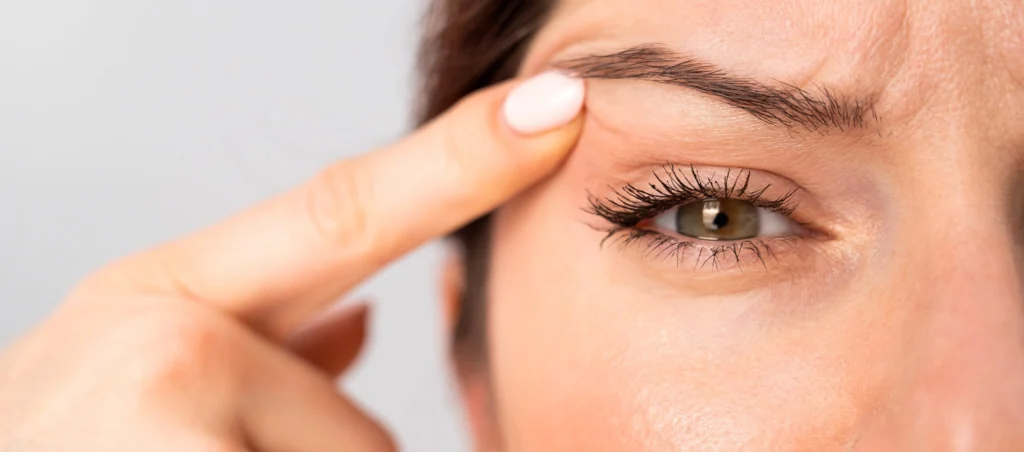 Botox raté à Paris : comment corriger et prévenir les complications (Guide Expert 2026) – Docteur Bernard Hayot botox rate hayot 01 – Docteur Bernard Hayot