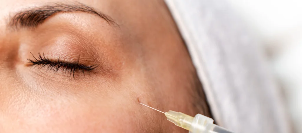 Fake Injectors Paris : Comment Reconnaître et Corriger les Injections Illégales – Docteur Bernard Hayot corriger injection ratee – Docteur Bernard Hayot