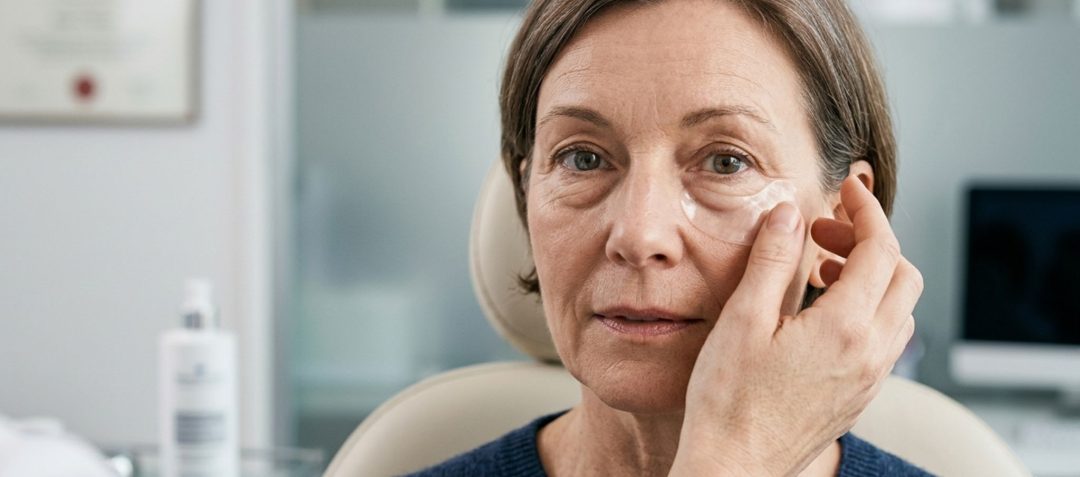 Bags under the eyes without surgery: effective and natural alternatives