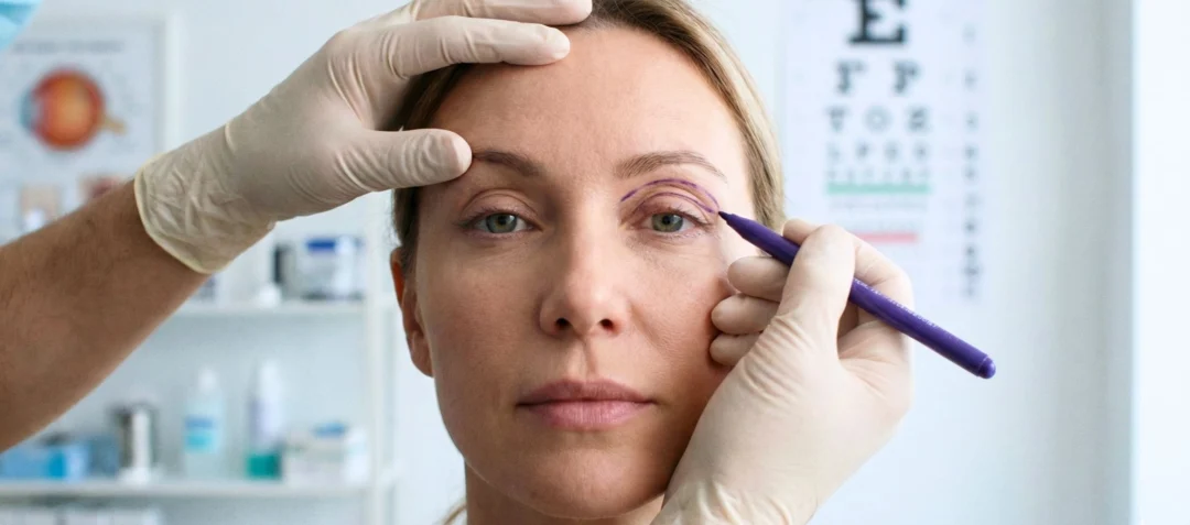 Parcours chirurgie et médecine esthétique du regard à Paris 8 : du diagnostic au suivi au Centre Esthétique Trémoille