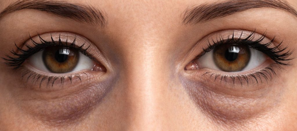 Regard fatigué: comment rajeunir naturellement – Docteur Bernard Hayot Regard fatigué chirurgie du regard