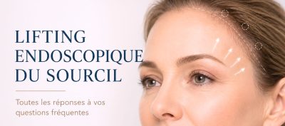 Lifting endoscopique du sourcil : 8 questions que me posent mes patients