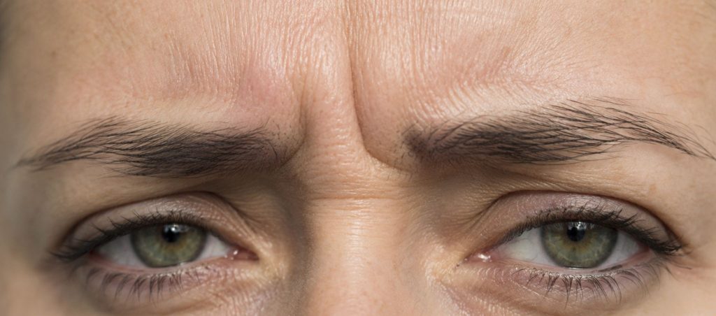 Botox du regard et patte-d'oie : ce qu'il peut faire – Docteur Bernard Hayot 5 – Docteur Bernard Hayot