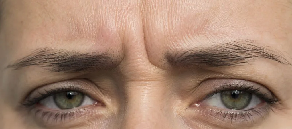 Botox du regard et patte-d'oie : ce qu'il peut faire – Docteur Bernard Hayot 5 – Docteur Bernard Hayot