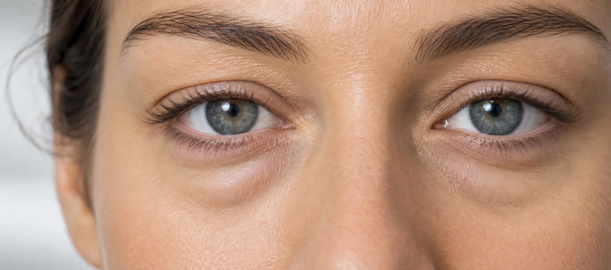 Gros plan anonyme du regard montrant des poches sous les yeux et un cerne creux