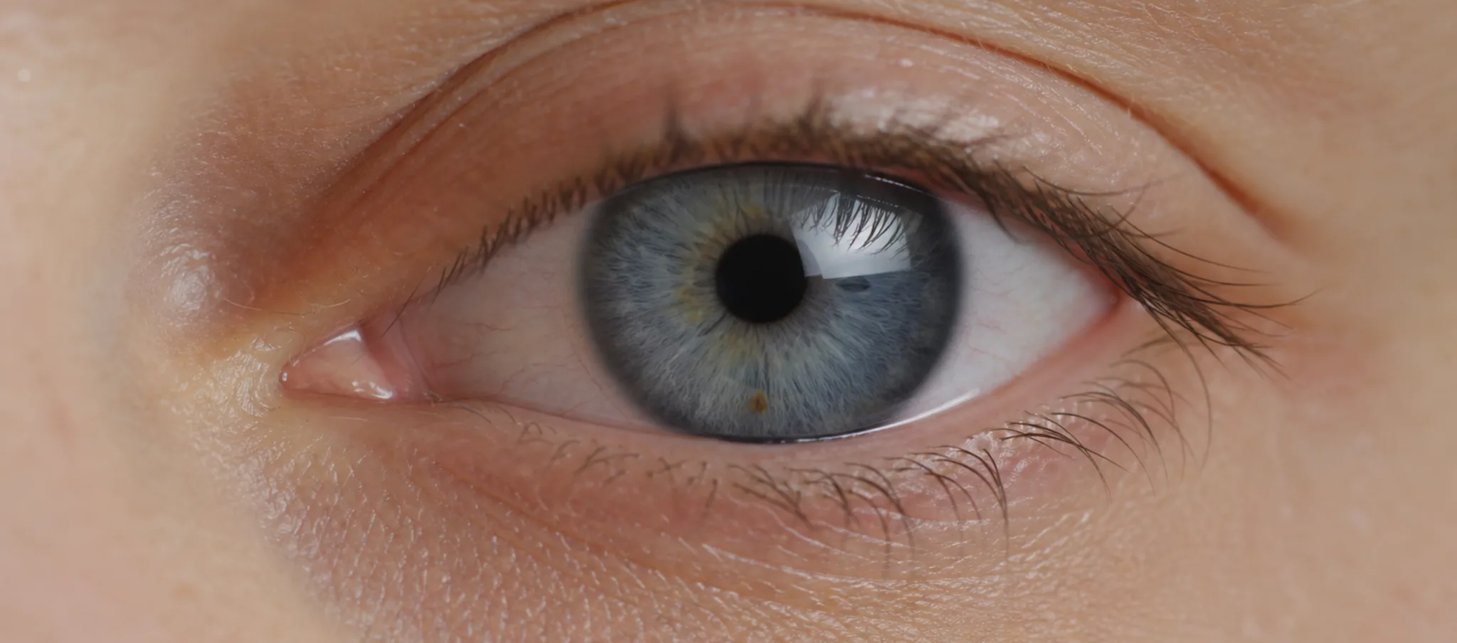 Œil et paupière à évaluer avant blépharoplastie en cas de sécheresse oculaire