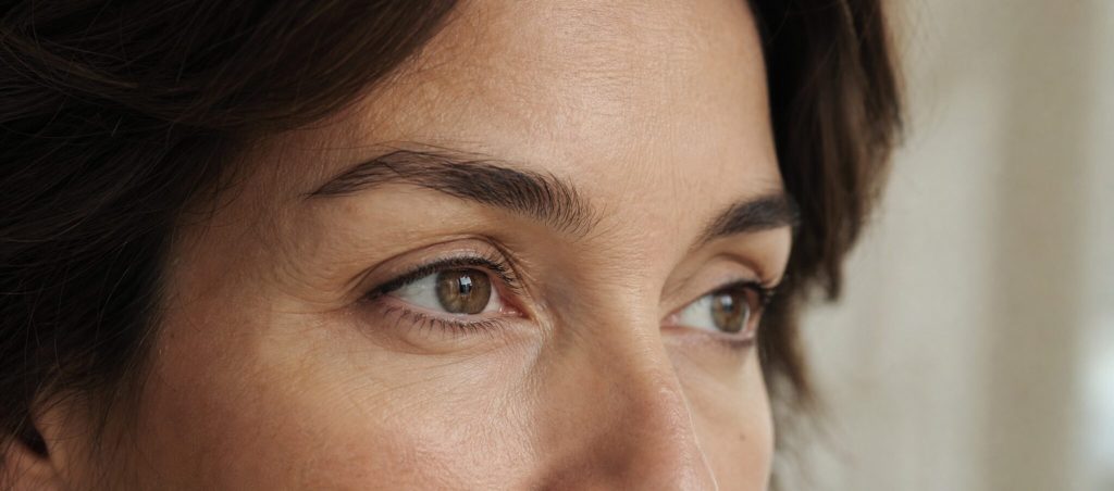 Foxy Eyes et Cat Eyes : canthopexie, canthoplastie ou lifting du sourcil ? – Docteur Bernard Hayot Regard de trois quarts montrant la paupière inférieure et l’angle externe de l’œil