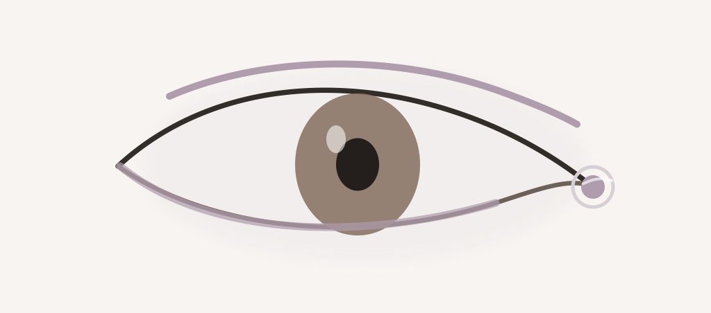 Foxy Eyes et Cat Eyes : canthopexie, canthoplastie ou lifting du sourcil ? – Docteur Bernard Hayot Schéma de la paupière inférieure, du canthus latéral et de la queue du sourcil