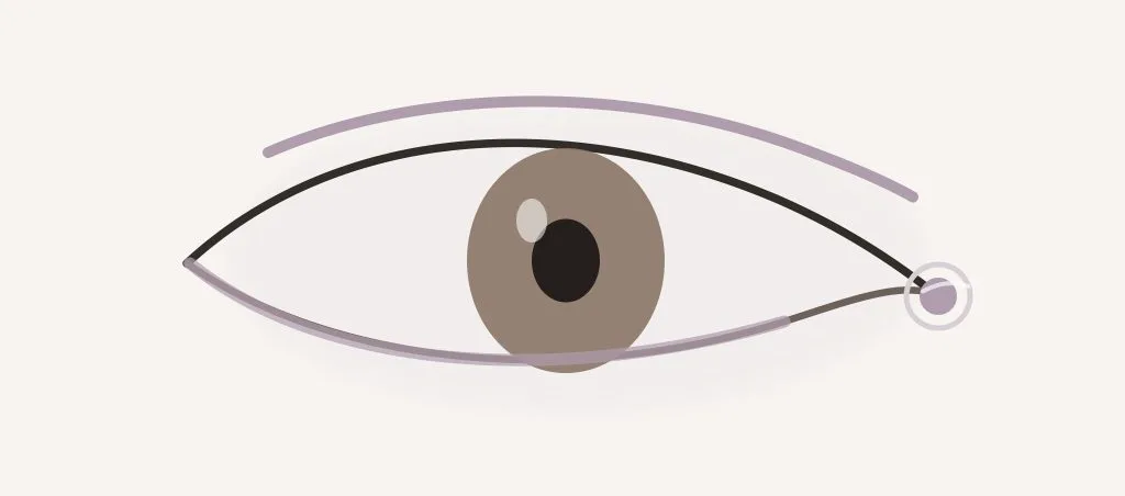 Foxy Eyes et Cat Eyes : canthopexie, canthoplastie ou lifting du sourcil ? – Docteur Bernard Hayot Schéma de la paupière inférieure, du canthus latéral et de la queue du sourcil