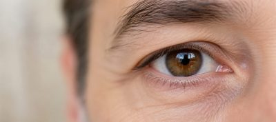 Home – Docteur Bernard Hayot Chémosis après blépharoplastie : reconnaître le gonflement de la conjonctive